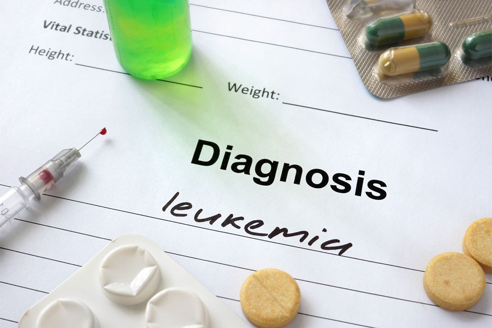 Acute Myeloid Leukemia &#8211; Stages, Types, Symptoms, Causes, and Therapies