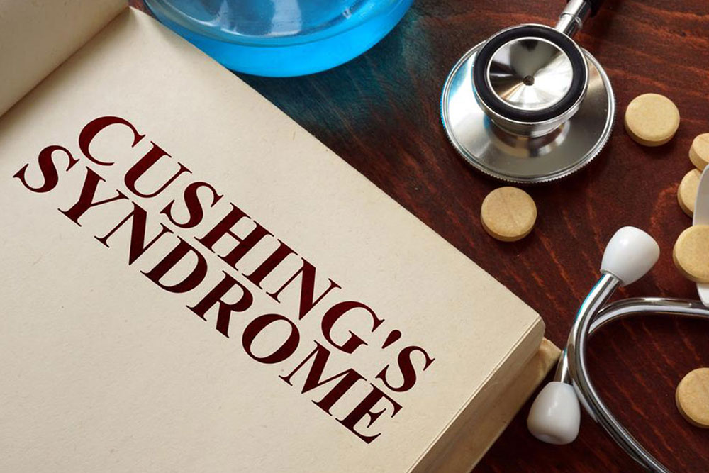 The symptoms of Cushing&#8217;s disease