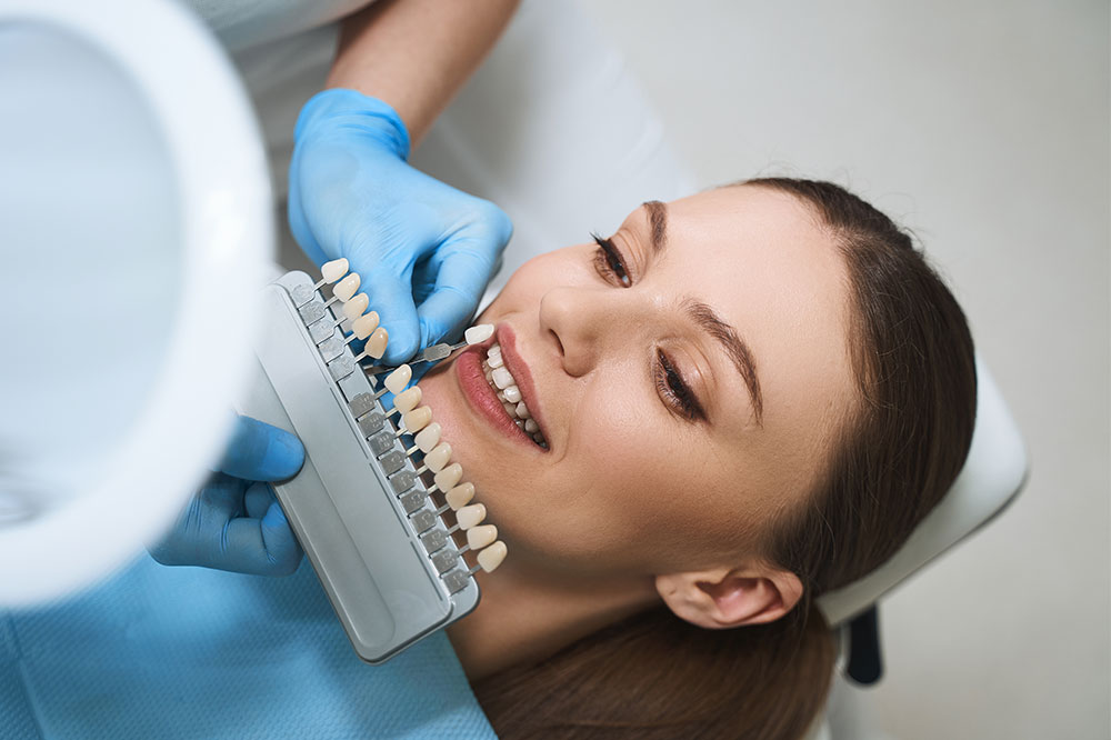 Things to know before opting for dental veneers