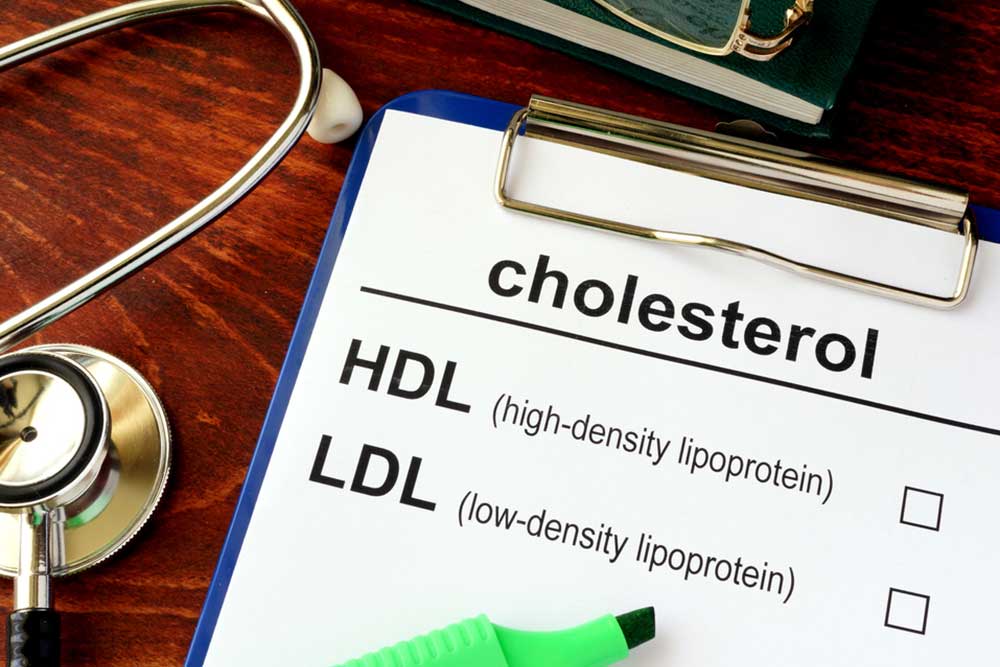 Tips to Lower Cholesterol Levels Naturally