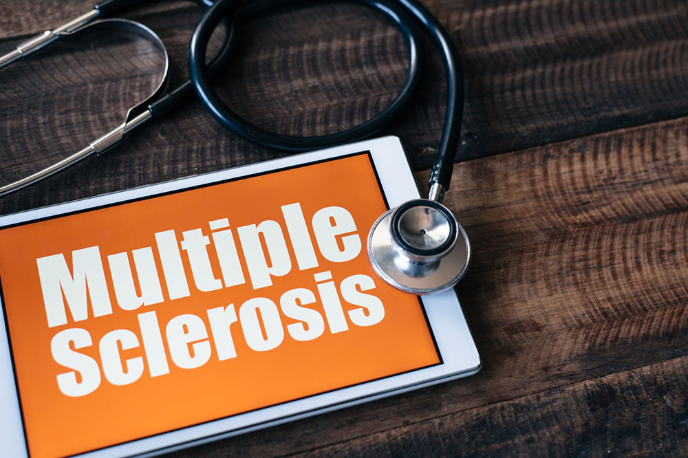 Here are some important things to keep in mind about multiple sclerosis