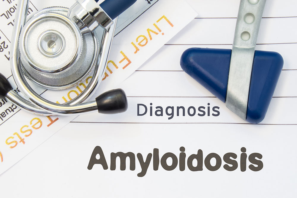 Two Types of Hereditary Amyloidosis You Need to be Aware of