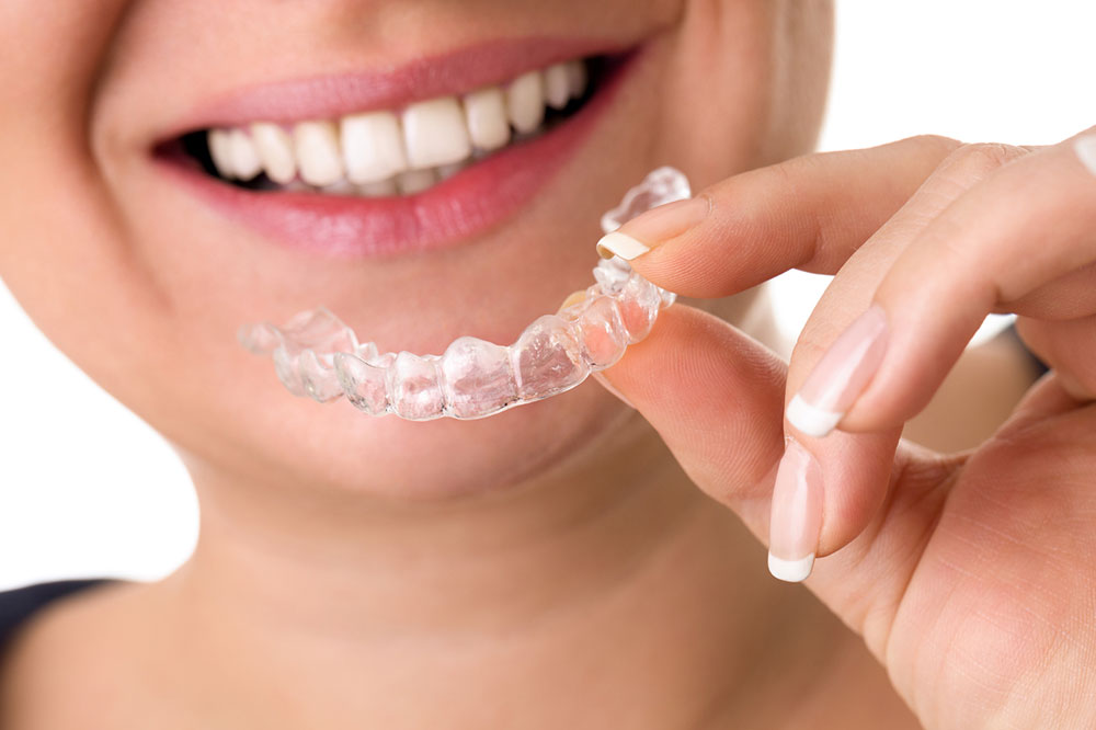 An overview of invisible teeth aligners braces