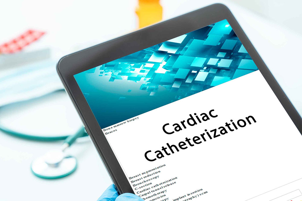 Everything to Know About Heart Catheterization Procedure