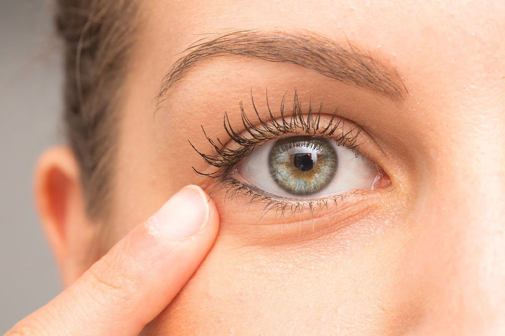 Tips to Find a Surgeon for Eye Bag Removal